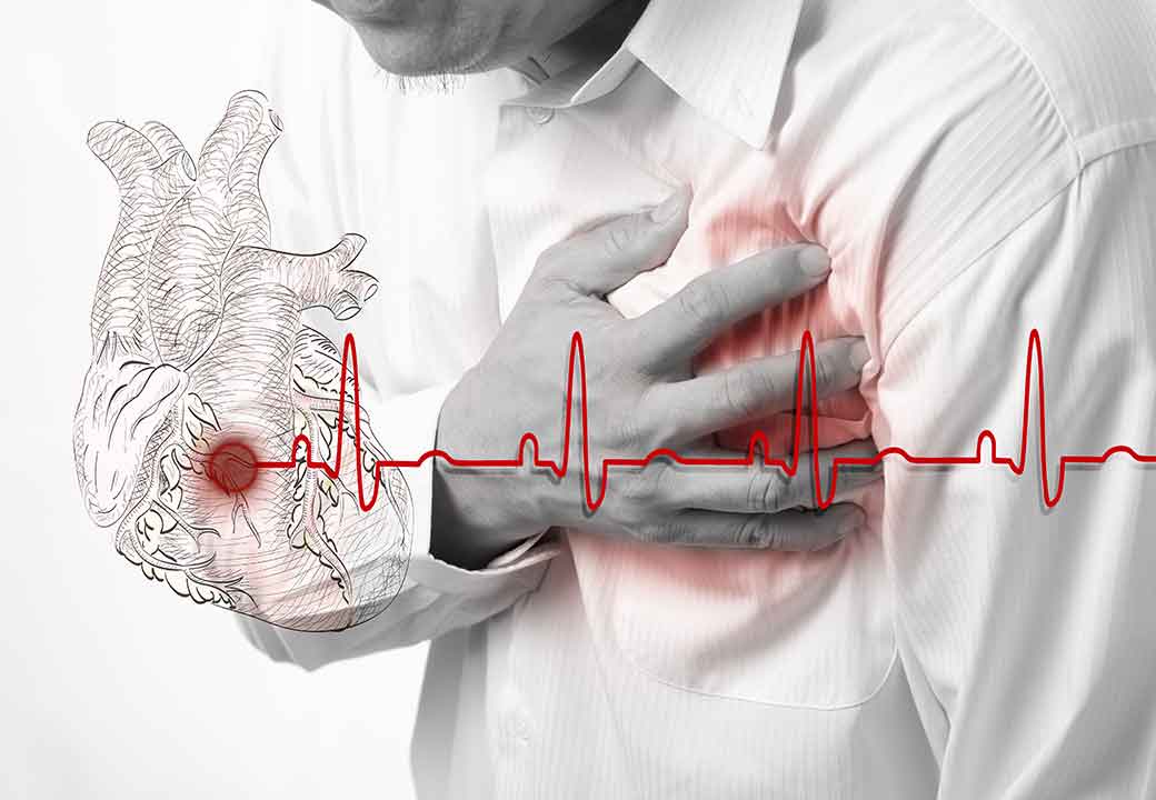 Возможная первопричина – ишемическая болезнь сердца